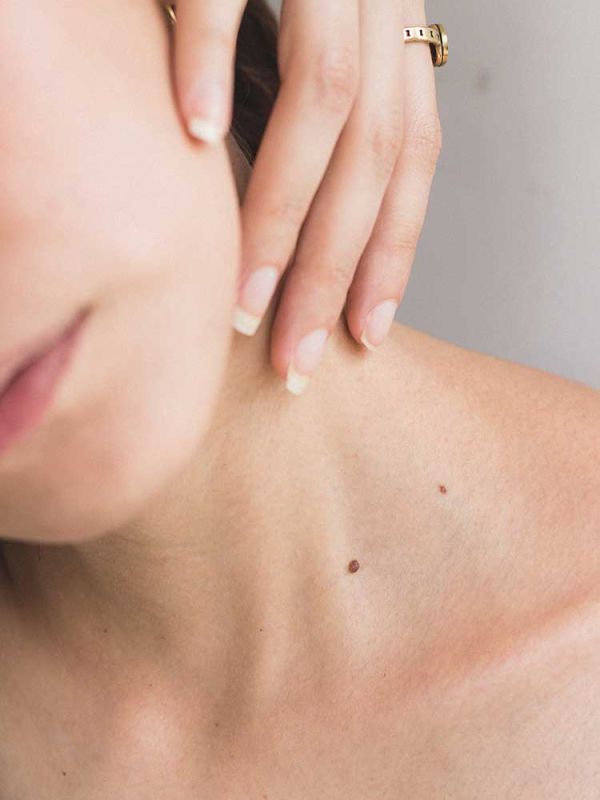 Skin cancer treatment in Tucson
